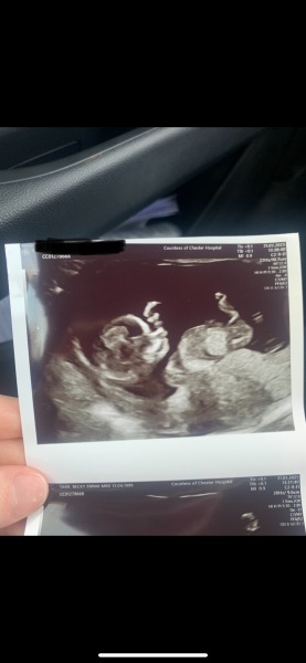 12 week scan gender guesses