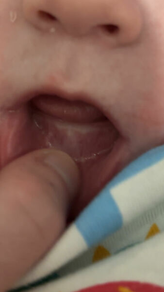 teething?