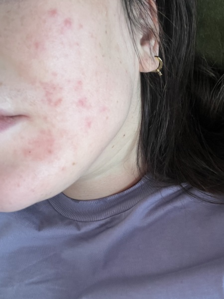 Please help, what’s wrong with my skin?
