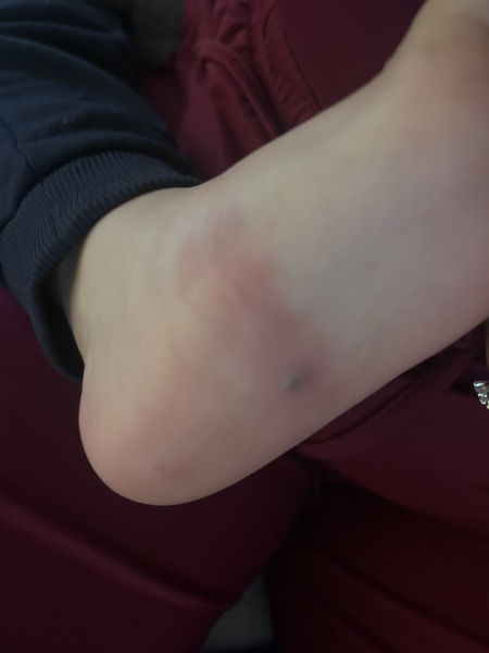 Does this look like tracking?