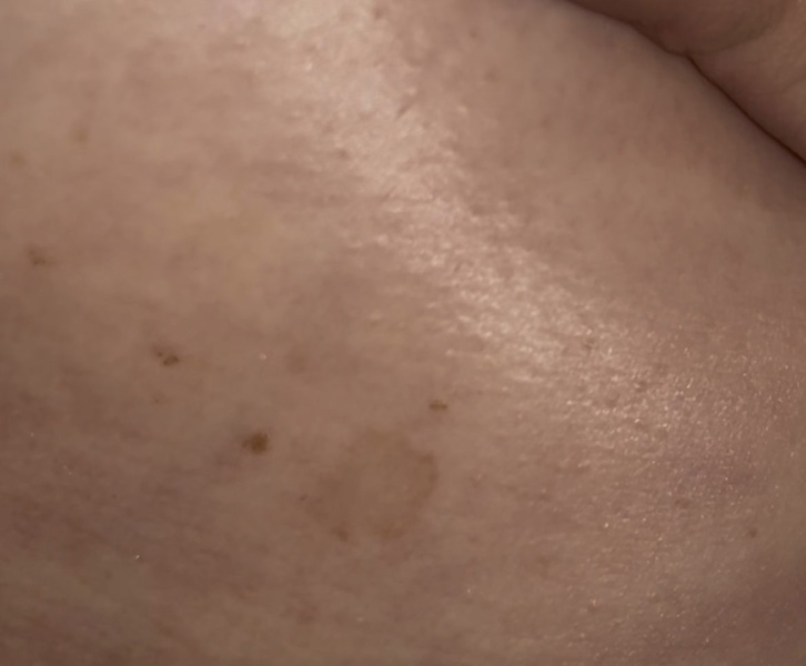 HELP, What is this on me ladies ?