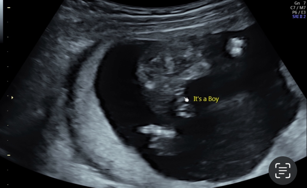 Potty gender scan
