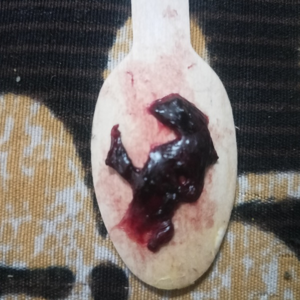 Is this a miscarriage??