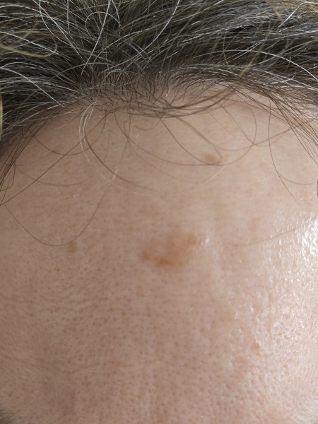 LED Face Masks-what do you use & hints & tips?