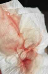 *graphic warning* Bleeding