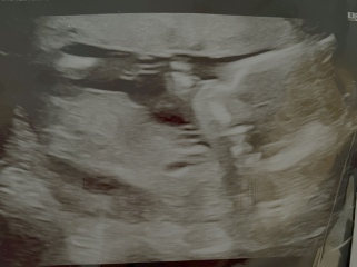 15+3 gender guesses