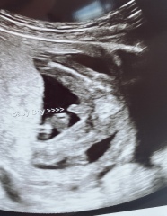 Potty shot - is this a boy?