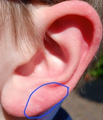 Medics of the Internet what is going on here? Pics attached