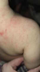 Does anyone know what this rash could possibly be?
