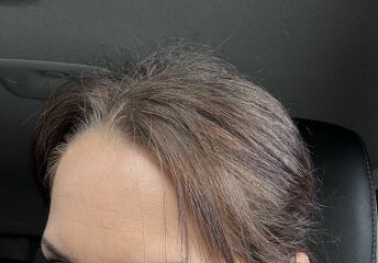 Should I continue growing out colour