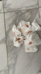 Scared - spotting and small bloody discharge