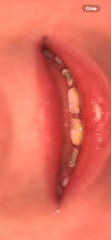Children’s teeth
