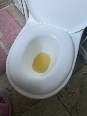 Toddler urine dark? Dehydrated?