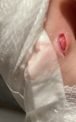 Cut hand
