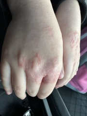 Any skin experts out there?!