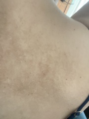 Does this look like sun damage?