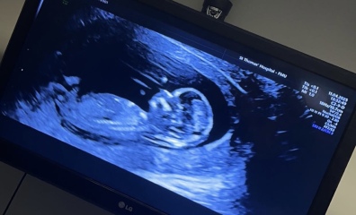 Can someone please help with gender prediction