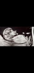 Boy or girl?
