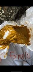 EBF nappy or allergy? Poo pics