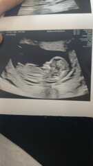 Girl or boy 12 weeks 3 days