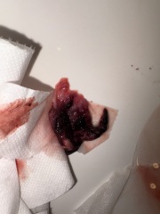 Is this discharge normal during miscarriage??