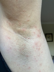 Unknown rash getting me down