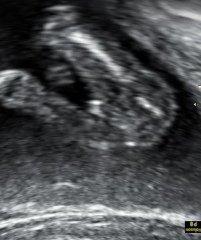 Potty shot - is this a boy?