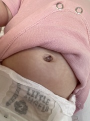 Does my baby’s belly button look normal?