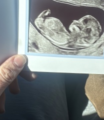 Girl or boy?