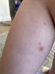 Multiple spots on body