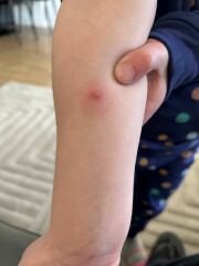 Multiple spots on body