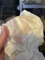 Spotting 8 dpo and 10 dpo