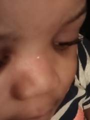 Baby just hit the bridge of his nose on side table (photo) 