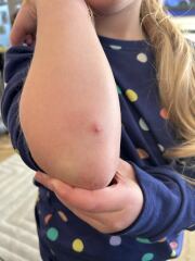Multiple spots on body