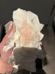 Spotting 8 dpo and 10 dpo