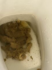 Four year old’s poo - very bizarre and concerning