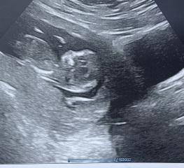 Guesses for sex of baby please