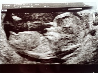 Any gender guesses please?!