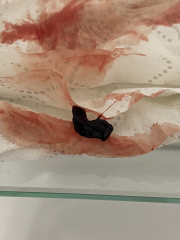 Is this miscarriage?