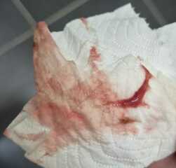 *graphic warning* Bleeding