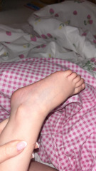 Does this look like chicken pox? Also I’m pregnant so need advice if so!