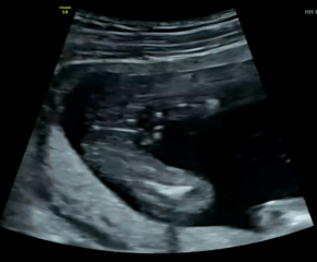 Gender Scan Help!
