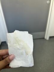 Missed pills & spotting