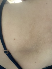 Does this look like sun damage?