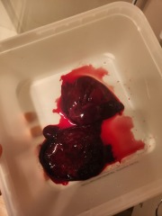 GRAPHIC PICS - Is this a miscarriage