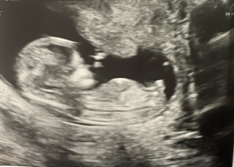 NUB/SKULL gender guesses?