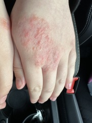 Any skin experts out there?!