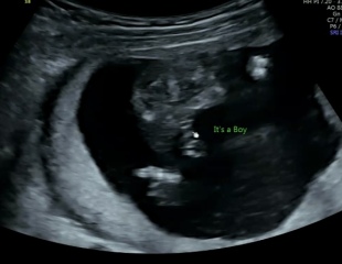 Potty shot - is this a boy?