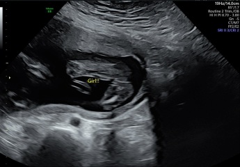 Is this definitely a girl?
