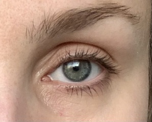 HELP! Creepy wrinkly skin around eyes at 27